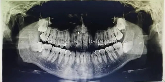 Strumenti di scansione CT dentale della società ZX